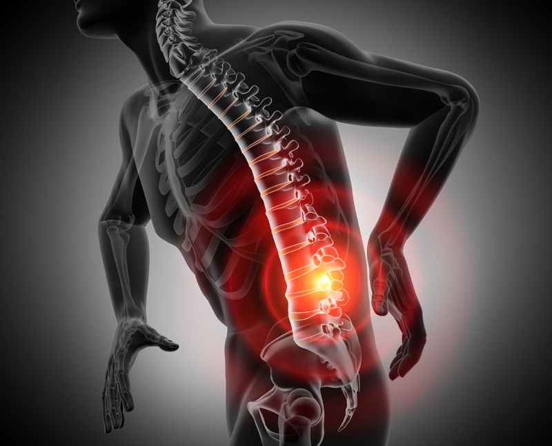 Image illustrant les problemes de dos situes sur la colonne vertebrale, ou outil pour réduire et prévenir les problèmes de dos